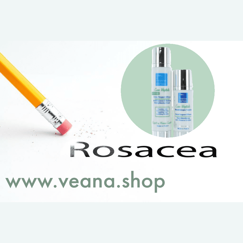 Rosacea - Informationen und Anzeichen